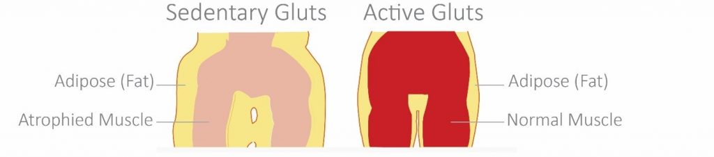 Sedentary glutes